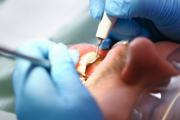 Best Urgent Tooth Repair  in Kingston Springs, TN