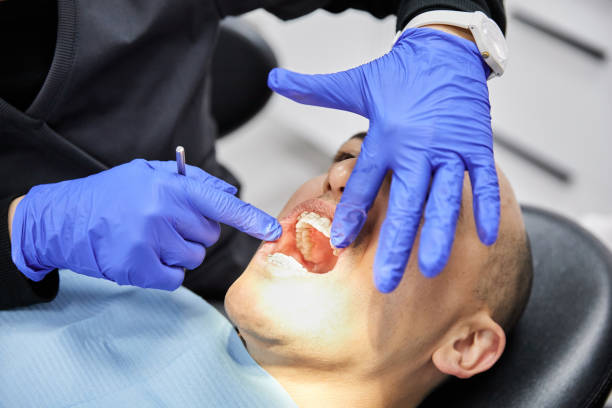Best Knocked-Out Tooth Emergency  in Kingston Springs, TN